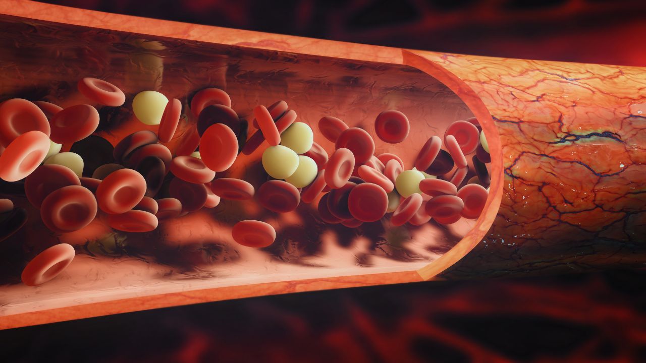 How Nitric Oxide Supplements Can Help Lower Blood Pressure